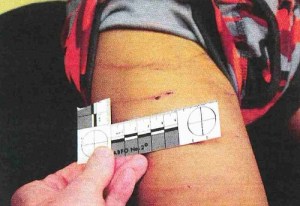 adrian-peterson-son-abuse-1